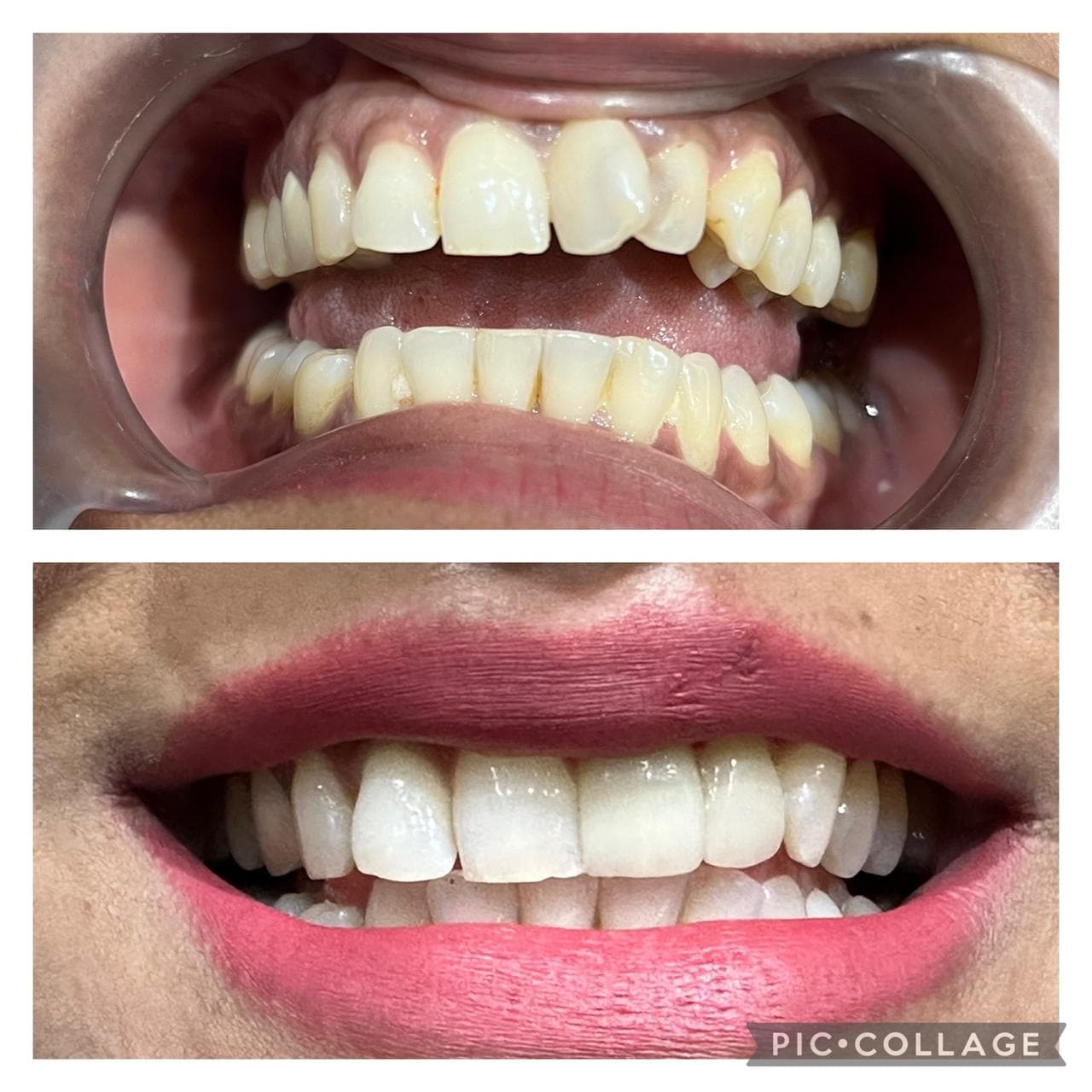 Cosmetic Dentistry